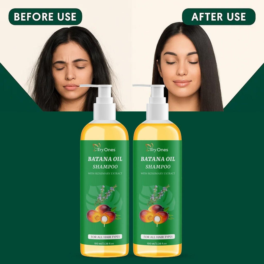 Rosemary & Batana Oil Shampoo – Hair Growth & Anti Hair Fall