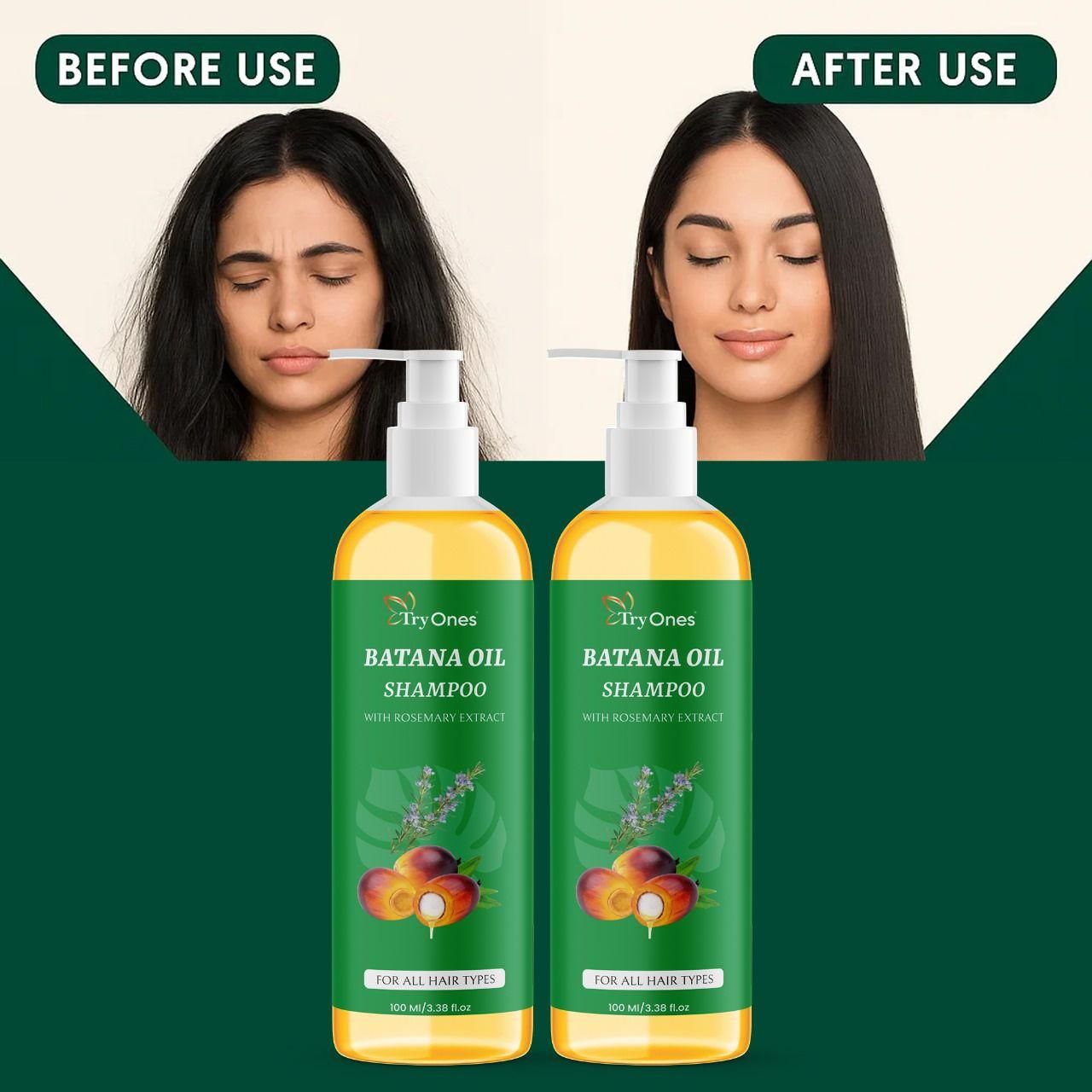 Rosemary & Batana Oil Shampoo – Hair Growth & Anti Hair Fall